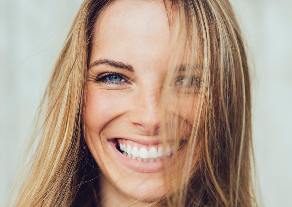 Gummy Smile Behandlung mit Botox | Frau lächelt in die Kamera nach Gummy Smile Botox Behandlung | Botox Wien